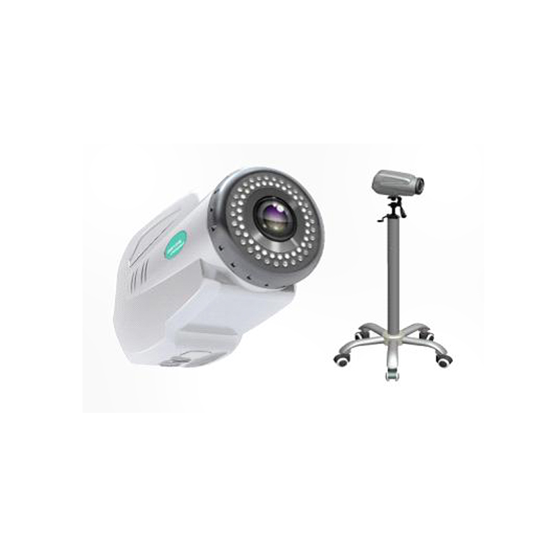 EC100 Electronic Colposcope